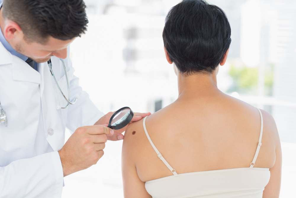 Skin Cancer Screening